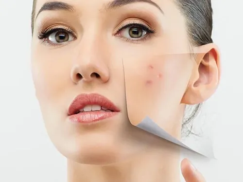 استفاده از بهترین روغن برای لک صورت